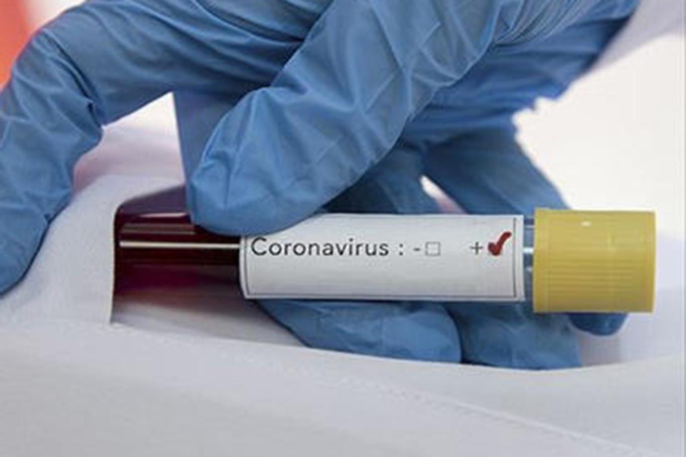  Almanya'da Coronavirus'ten ölenlerin sayısı 1048'e yükseldi